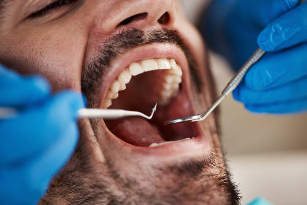 Best Emergency Dental Care for Broken or Chipped Teeth in West Point, KY
